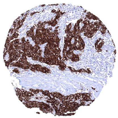 [sk1893] Uroplakin 1B (MSVA-734M)