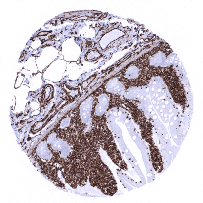 von Willebrand Factor / vWF (MSVA-521R)