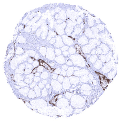 von Willebrand Factor / vWF (MSVA-521R)